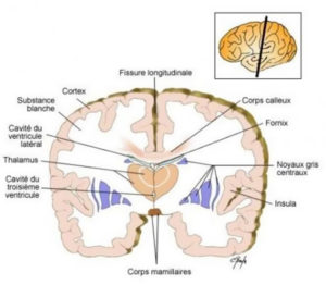 schema2